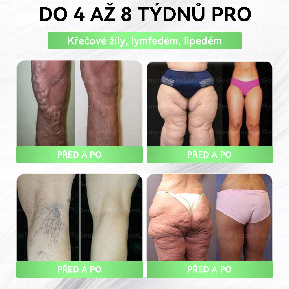 Oficiální prodejna BENU | 🎁 𝐆𝐞𝑒𝑙𝑒𝐦𝐨𝐧® Glum𝐚𝐬𝐞tide 8 v 1 – Zeštíhlující nano mikrojihlový náplast 🇨🇿 Jen 1× denně ✅ Viditelné změny za 7 dní – na obezitu, kardiovaskulární zdraví, diabetes a kloubní problémy