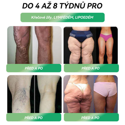 🌿 Oficiální obchod ČR | STDEI® GLP-1 8-v-1 Fit & Vital Řešení (Jednou denně, viditelné změny za 7 dní) ✅ Obezita, kardiovaskulární zdraví, cukrovka, spánková apnoe, zdraví střev, problémy se klouby a dalš